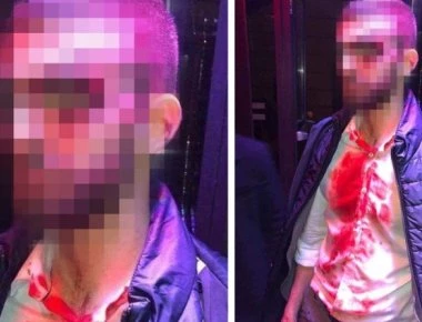 Βίντεο: Πώς ξεκίνησε η σύρραξη στο μαγαζί που τραγουδάει ο Σαμπάνης- Με 120 ράμματα ο νεαρός θαμώνας